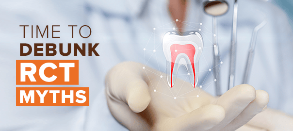 Root Canal Myths Explained